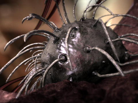 Monsters Inside Me: Köttätande bakterie