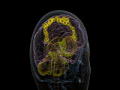 Curiosity: Brain Activity