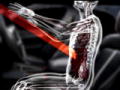 Body Invaders: Impaled On Spike