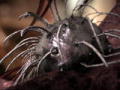 Monsters Inside Me: Flesh Eating Bacteria