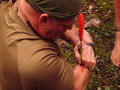 Dual Survival: Self-Inflicted Wound