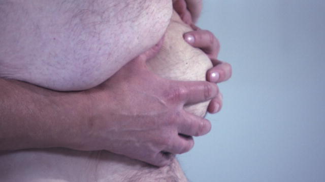 Health: Hernia Bursts Out