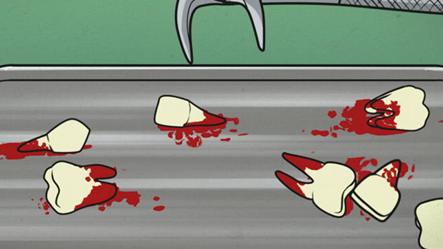 Investigation: Tooth & Consequences