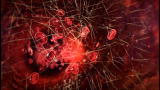 Killer Outbreaks: E. Coli 0157