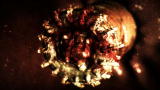 Monsters Inside Me: Gnathostoma Worms