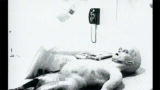 Is This Footage Of An Alien Autopsy?