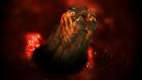 Monsters Inside Me: Parasite Eats Boy's Eye