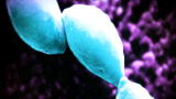 Monsters Inside Me: Toxoplasma Parasite