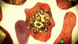 Monsters Inside Me: Malaria Parasite