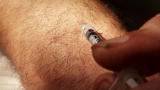 Fatal Attractions: Man Injects Self With Snake Venom