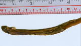 Weird, True & Freaky: Fish Attacks Man's Urethra