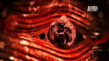 Monsters Inside Me: Worms Burrow Through Flesh