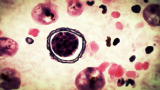 Monsters Inside Me: The Acanthamoeba Parasite