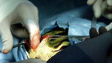 Weird True & Freaky: Pet Iguana Swallows Coins