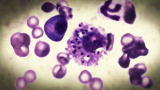 Monsters Inside Me: The Leishmania Parasite