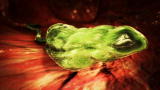 Monsters Inside Me: Leishmaniasis and Skin Sores