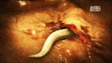 Monsters Inside Me: Worms Crawling Under My Skin