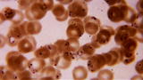 Monsters Inside Me: The Deadliest Parasitic Disease
