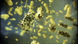 Killer Outbreaks: Anthrax