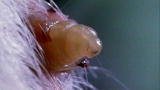 Monsters Inside Me: Invasion of the Botfly