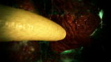 Monsters Inside Me: Dead Worms Block Gut