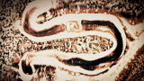 Monsters Inside Me: Threadworm Invades Body