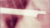 Weird True & Freaky: Puppy Swallows Kitchen Knife