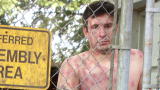 Untold Stories of the E.R. (Season 6): Naked Man Covered in Cactus Needles