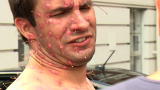 Untold Stories of the E.R. (Season 6): Man Gets Bikini Wax