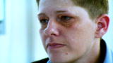 Embarrassing Bodies: Facial Growths