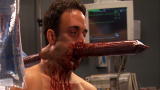 Untold Stories of the E.R. (Season 6): Man Texts With Pipe in Head