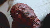 Dr. G: Medical Examiner: Burning Questions