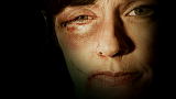 Facing Trauma: Facing Trauma