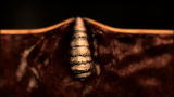 Monsters Inside Me: Botflies