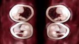 Amazing Families (VOD): Double Identical