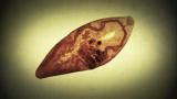 Monsters Inside Me: Lungworms