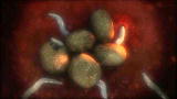 Monsters Inside Me: Toxocariasis