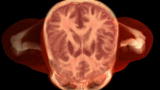 Sexual Health - Anatomy Of Arousal
