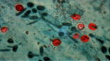 Monsters Inside Me: Cryptosporidium