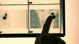 Diseases: Breast Diagnosis
