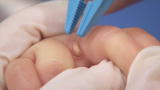 Untold Stories of the E.R.: Maggots in My Baby