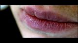Embarrassing Bodies: Swollen Lips