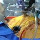 Second Opinion with Dr. Oz: Alternative Medicine: Robotic Surgeries