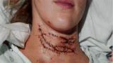 Facing Trauma: The Road to Recovery