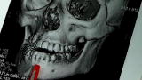 Medical Mysteries (VOD): Girl with Half a Face