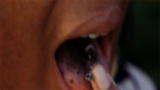 My Strange Addiction: Eating Cigarette Ashes