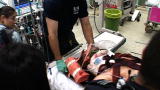 Shock Trauma: Struck by a Bulldozer