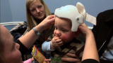 Too Many Babies? How They Do It: Reshape those baby heads