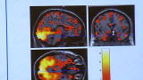 Sexual Health - Sexual Images
