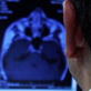 Mystery Diagnosis: A Case of Paralysis